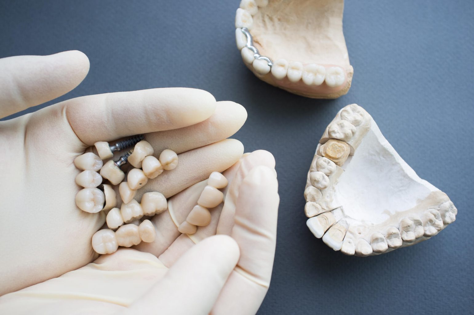 Where can I get Dental Implants Oak Park?