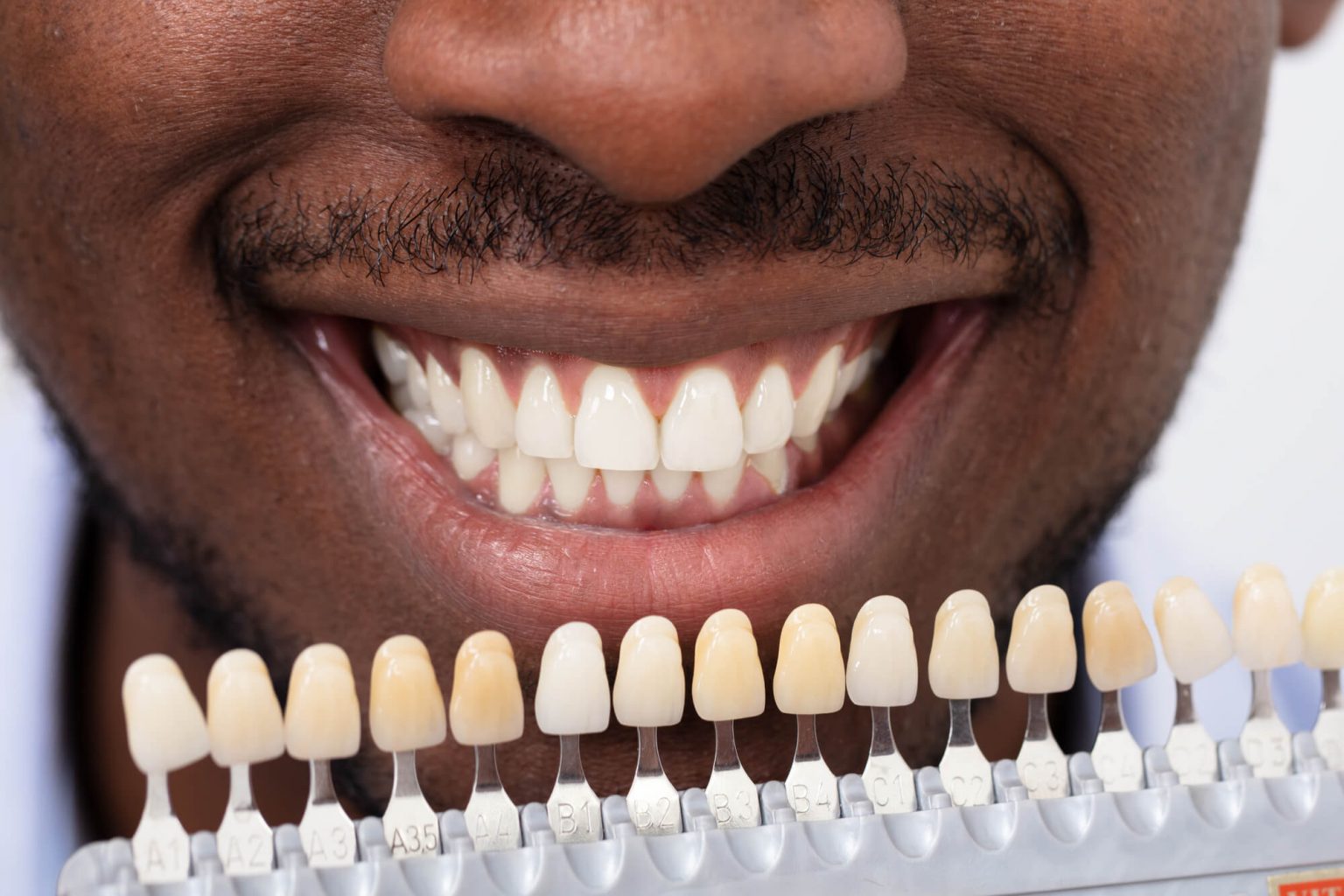 Where can I get Dental Implants Oak Park?