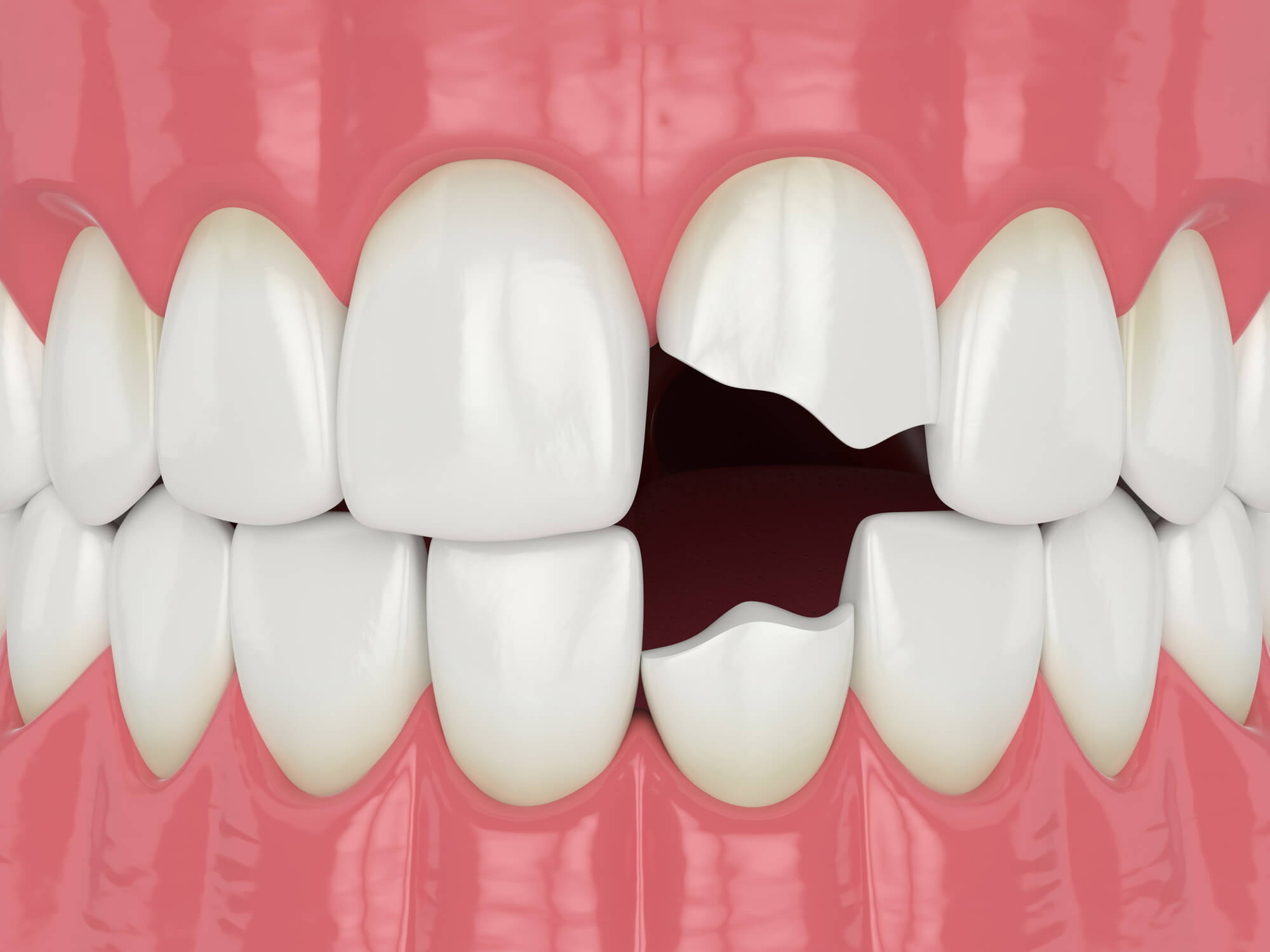 Who is the best Emergency Dentist Oak Park?