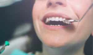 Emergency Dentistry: How to Handle a Broken or Loose Crown